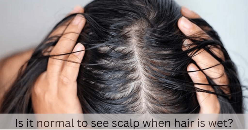 is it normal to see scalp when hair is wet?
